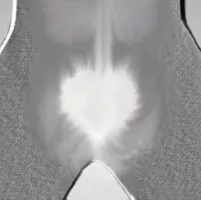 The location of the lower heart is between the thighs, just above the perineum.